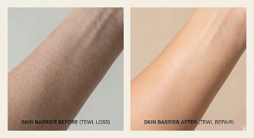Comparison of dry, flaky skin versus hydrated, barrier-repaired skin after TEWL-focused skincare routine.
